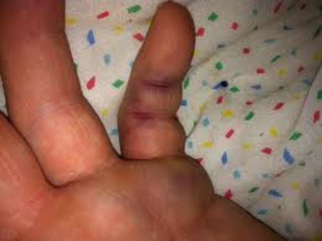 The Year I Broke My Finger