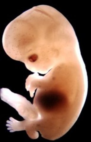 10 Weeks - Embryo to Fetus