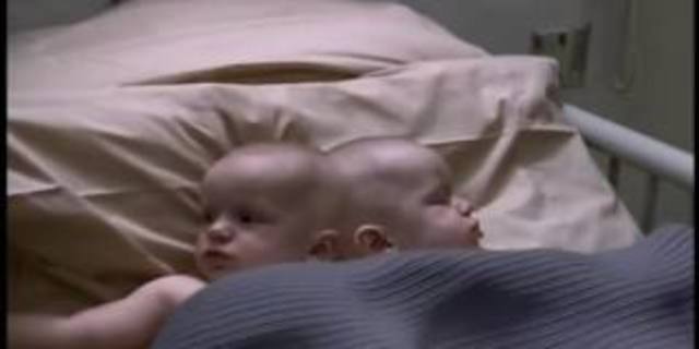 Separación de Gemelos por parte de Ben