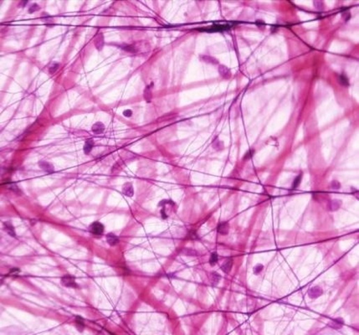 Rulf Virchow determines cells developed ok tissue fessed tissues