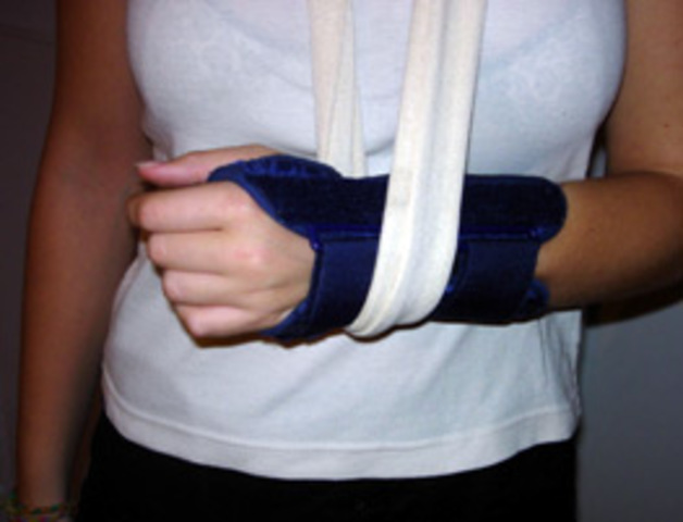 Yo me rompio la muñeca