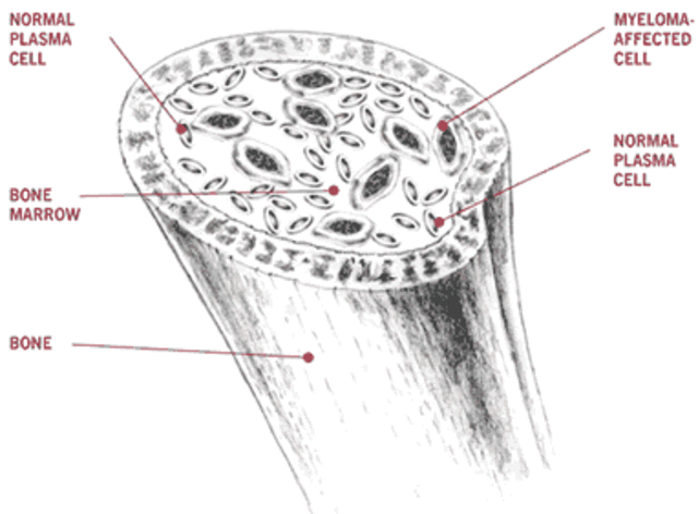 Rudolf Virchow- Cells in Bones