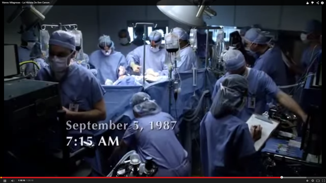 Operacion de los siameses