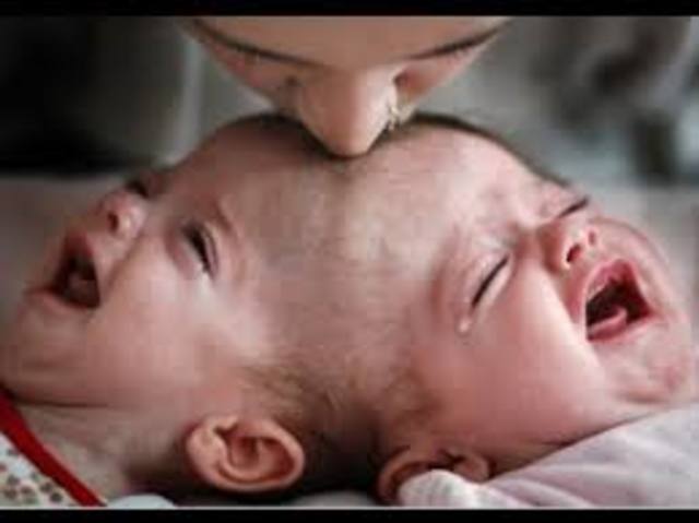 Ben decide operar a los gemelos