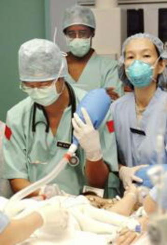 Comienza cirugia Siameses