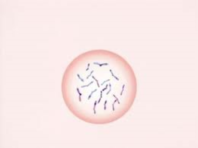 Rudolf Virchow Cell Theory