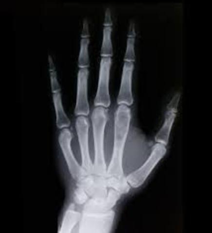 He started working with X-rays.