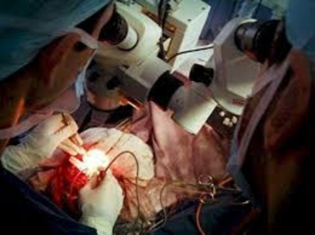 la cirugia mas dificil