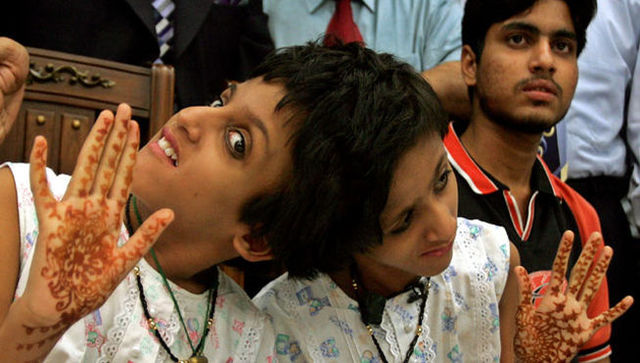 fin de las  ziamesas