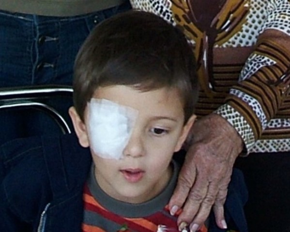 João-O corte no olho