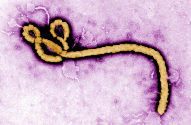 Ebola