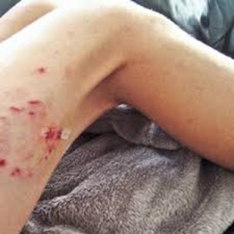 83 children die from rabies in Angola