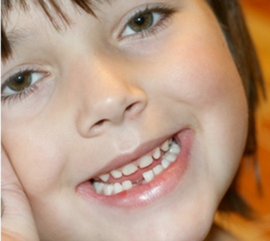 Tuve problemas dentales.