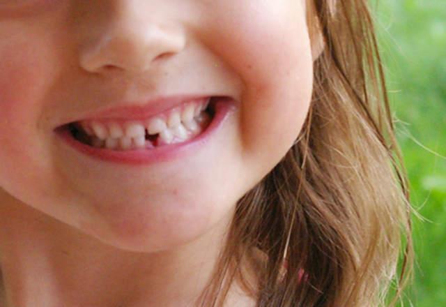 Me perdí la primera diente.