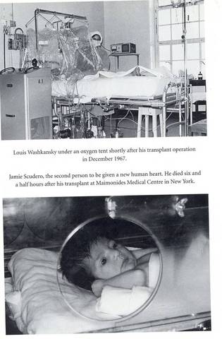 Baby Fae Recieves a Baboon Heart Transplant