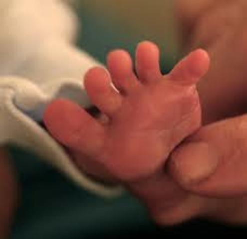 grows out of babinski reflex (cognitive)