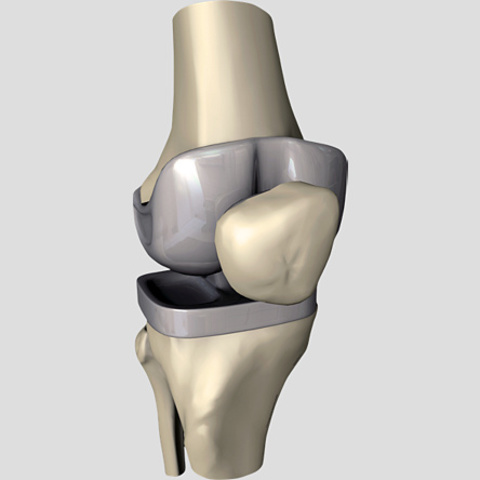 Neuromuscular and Joint Replacement practices increase