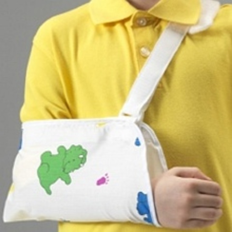 El Día Que Yo Rompí Mi Codo