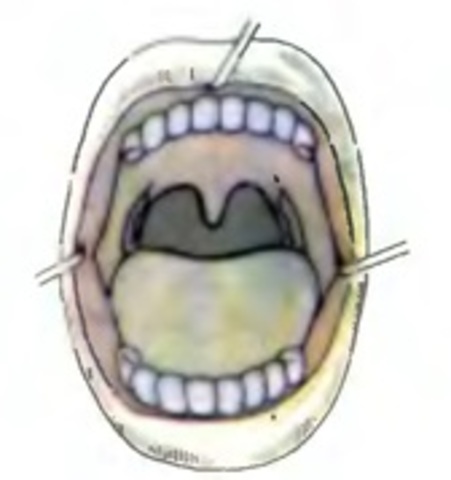 18-20 месяцев