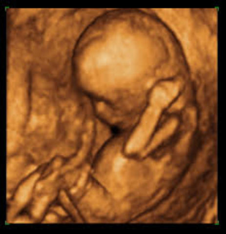 Semana 17 a 20 de embarazo