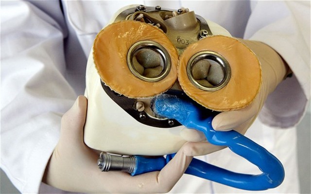 Artificial Heart