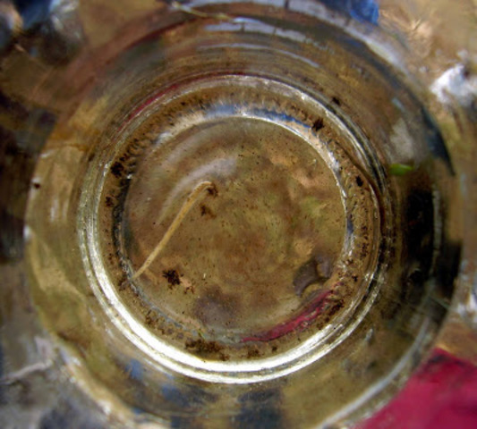 Descubrimiento de unas esporas blancas que eran huevos de sanguijuela.