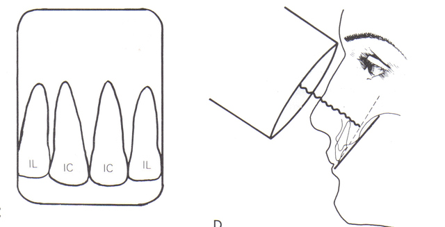 TÉCNICA DE PARALELISMO