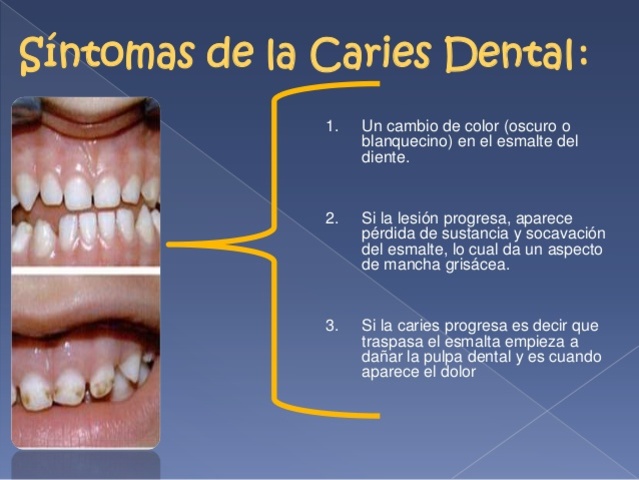 SINTOMAS DE LA CARIES