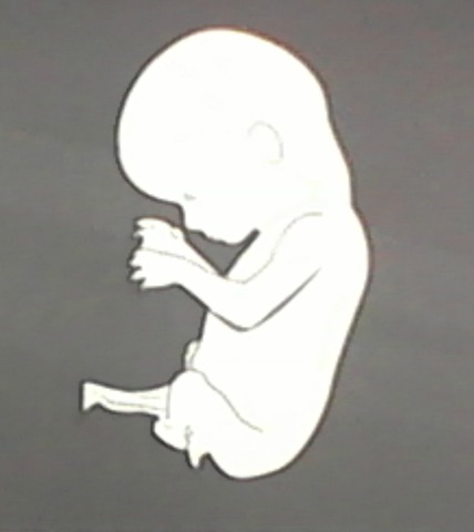 Semana 10 y 11 (Desarrollo Embrionario)