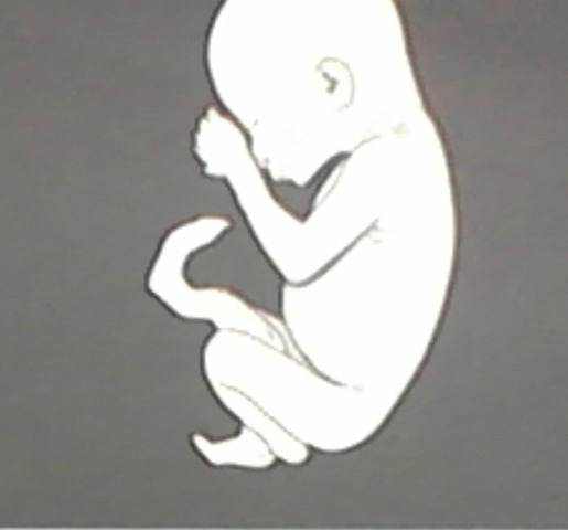 Semana 13 a 15 (Desarrollo Embrionario)