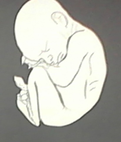 Semanas 21 a 25 (Desarrollo Embrionario)