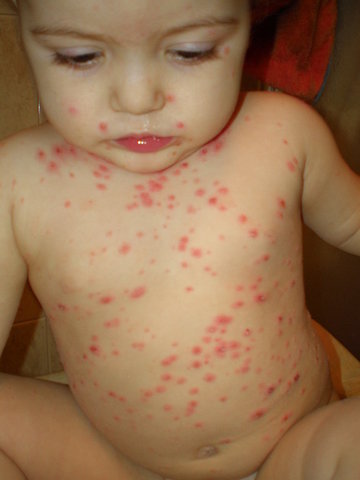 when I left the baricela