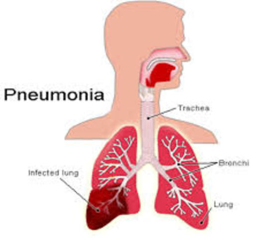 Albert Victor dies George’s brother
