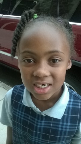 Lost my top front tooth