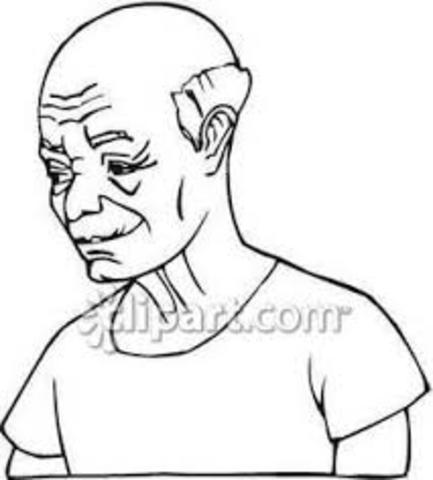 Too much hair have been lost