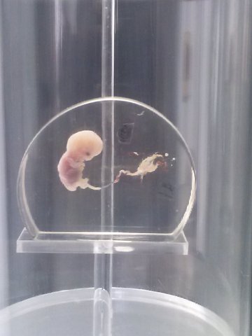 embriones de 8 y 9 semanas