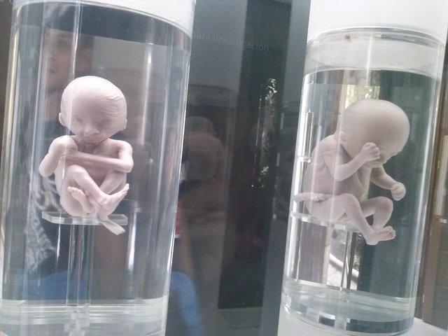 Feto de 15 a 16 semanas