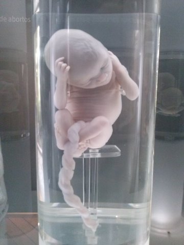 Fetos de 17 a 20 semanas