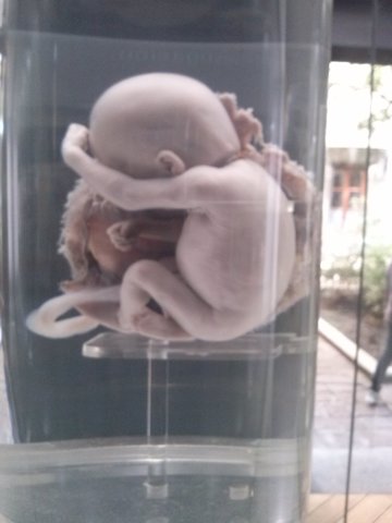 Feto de 26 a 29 semanas