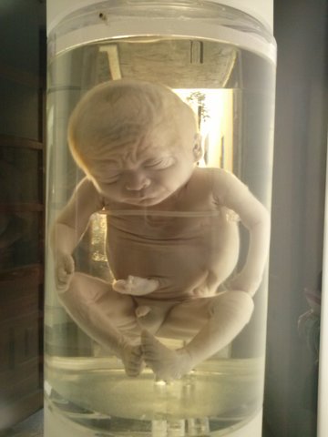 Feto de 30 a 38 semanas