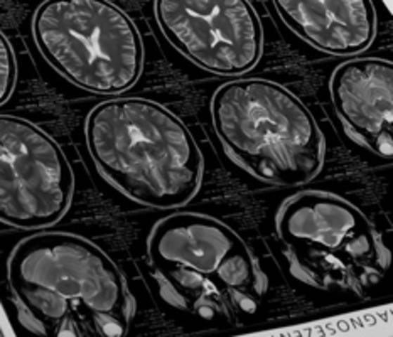 Begin Working as a Clinical Neuropsychologist