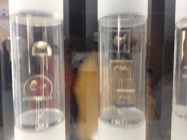 EMBRIONES DE 8 Y 9 SEMANAS