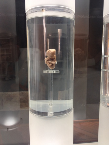 ETAPA FETAL (FETO DE 12 SEMANAS)