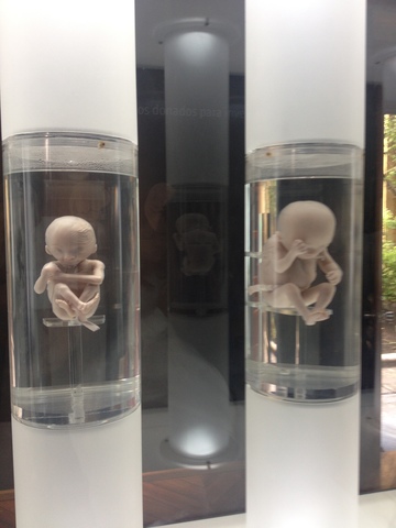 FETOS DE 15 A 16 SEMANAS