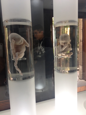 FETOS DE 17 A 20 SEMANAS