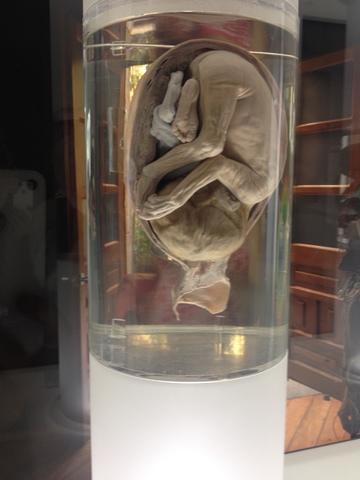 FETO DE 26 A 29 SEMANAS