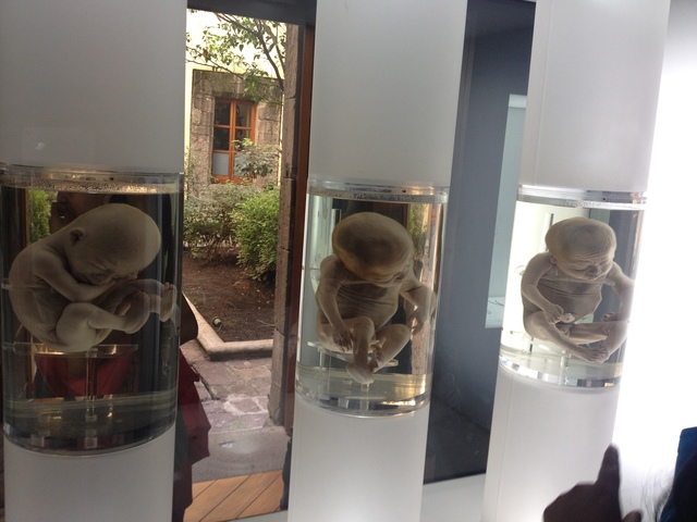 FETOS DE 30 A 38 SEMANAS