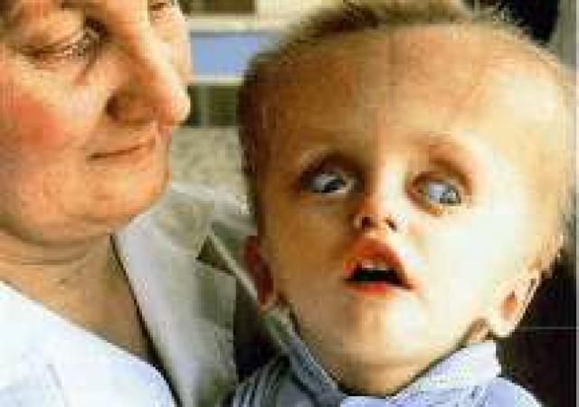 desastre núclear en chernobyl