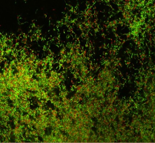 第一次完成共聚焦