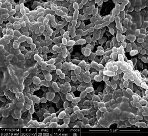 *第一次完成扫描电镜